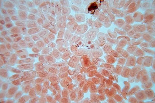 How a Gastroenterologist Can Transform Your Digestive Health Naturally